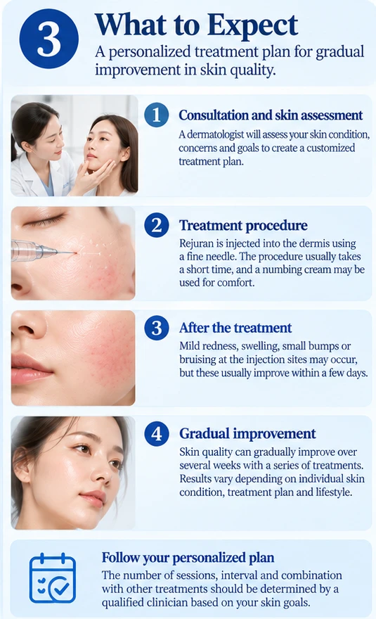 Illustration: what to expect from Rejuran, from consultation and treatment procedure to aftercare and gradual improvement